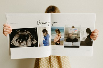 A woman holds up a baby book with an ultrasound and pregnancy photos.