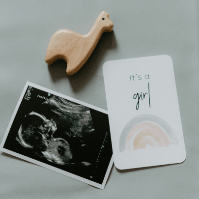 Ultrasound and pregnancy milestone card that says it's a girl